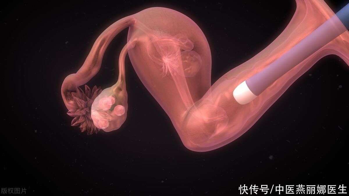 不孕症