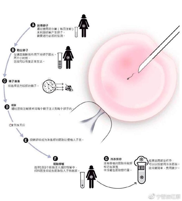 武汉试管婴儿费用