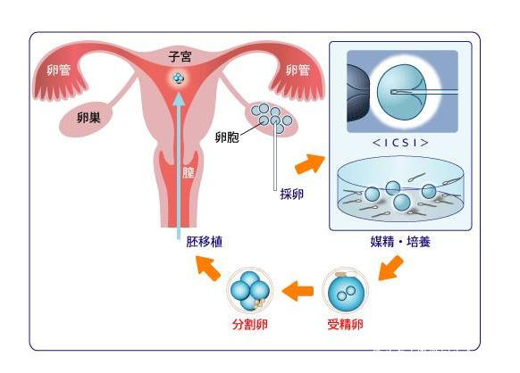 武汉不孕