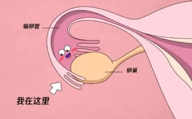 不孕不育