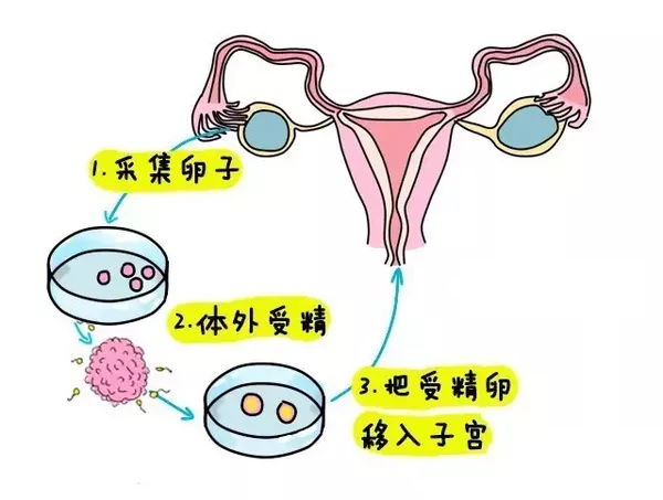 武汉做婴儿试管多少钱
