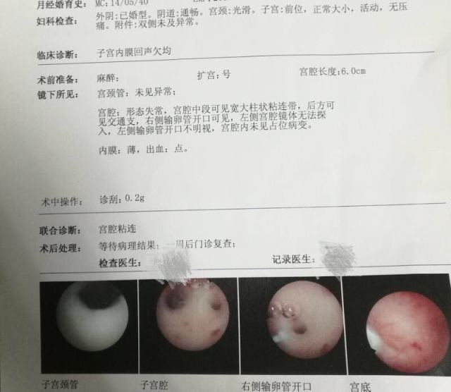 杭州 试管婴儿 三代