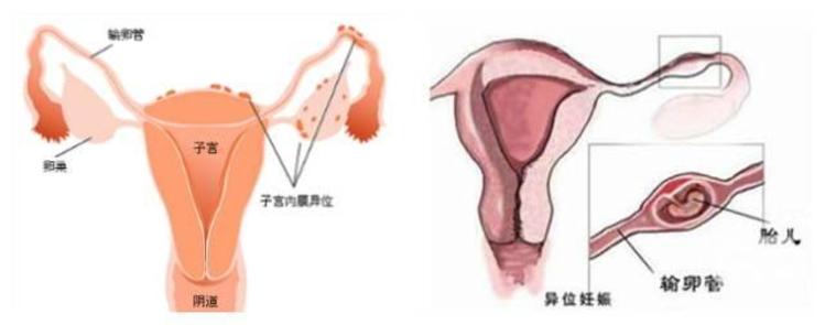 借卵生子