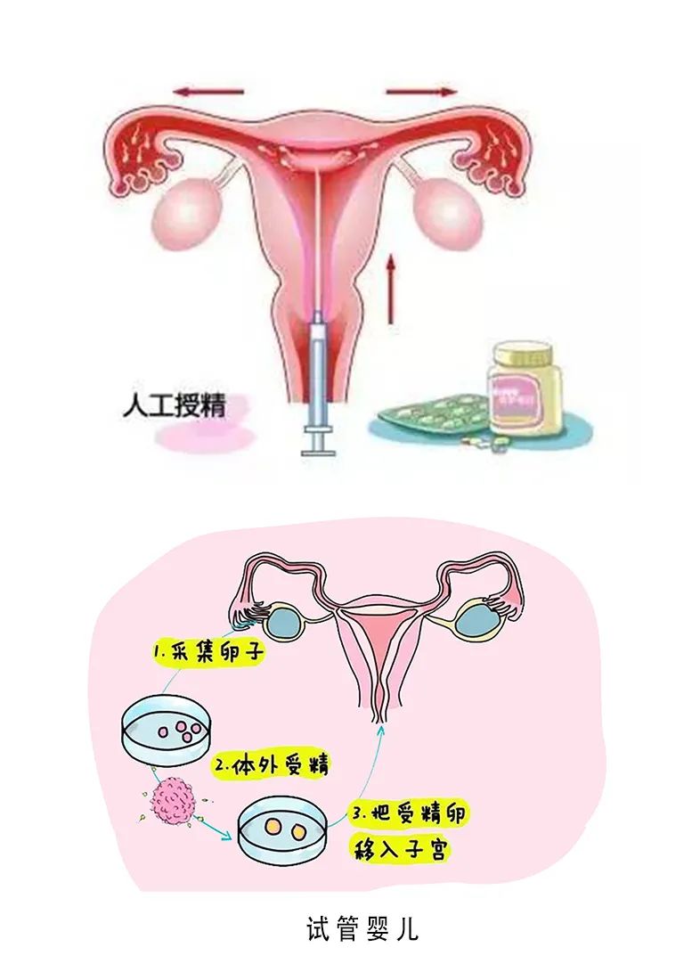 借卵生子