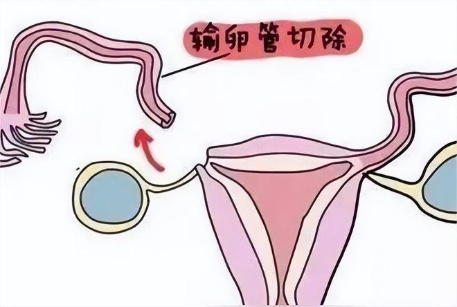 借卵试管