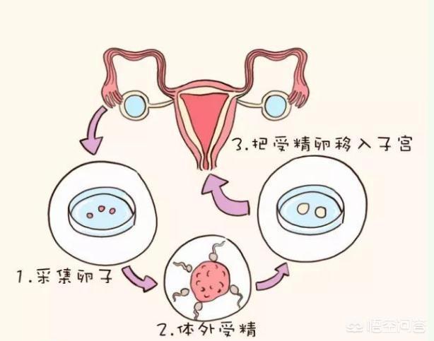 借卵试管