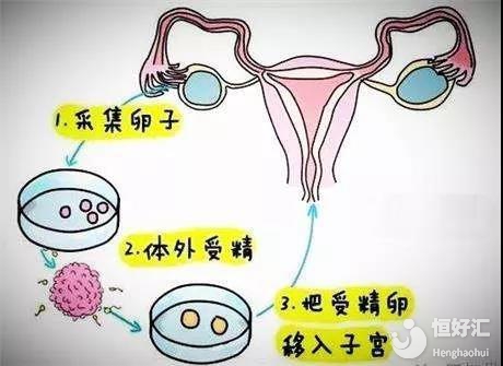 借卵生子